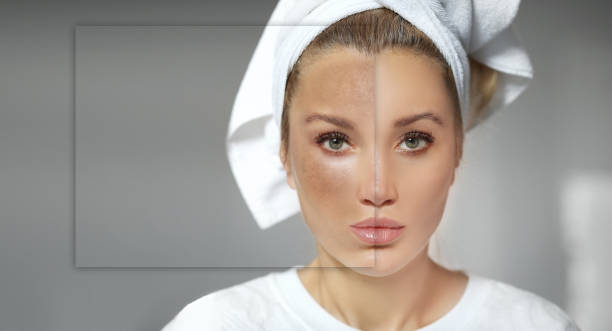 alt="Half face showing Tan skin vs glowing fair skin – comparison of tan dull skin and bright skin after treatment"